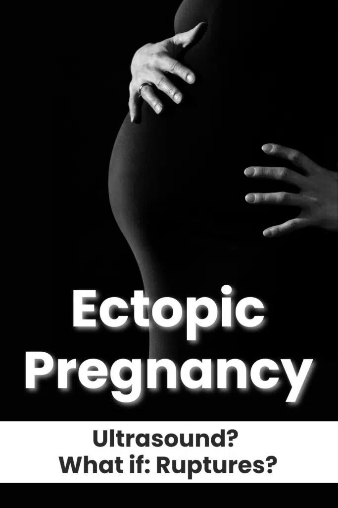Ectopic Pregnancy on Ultrasound