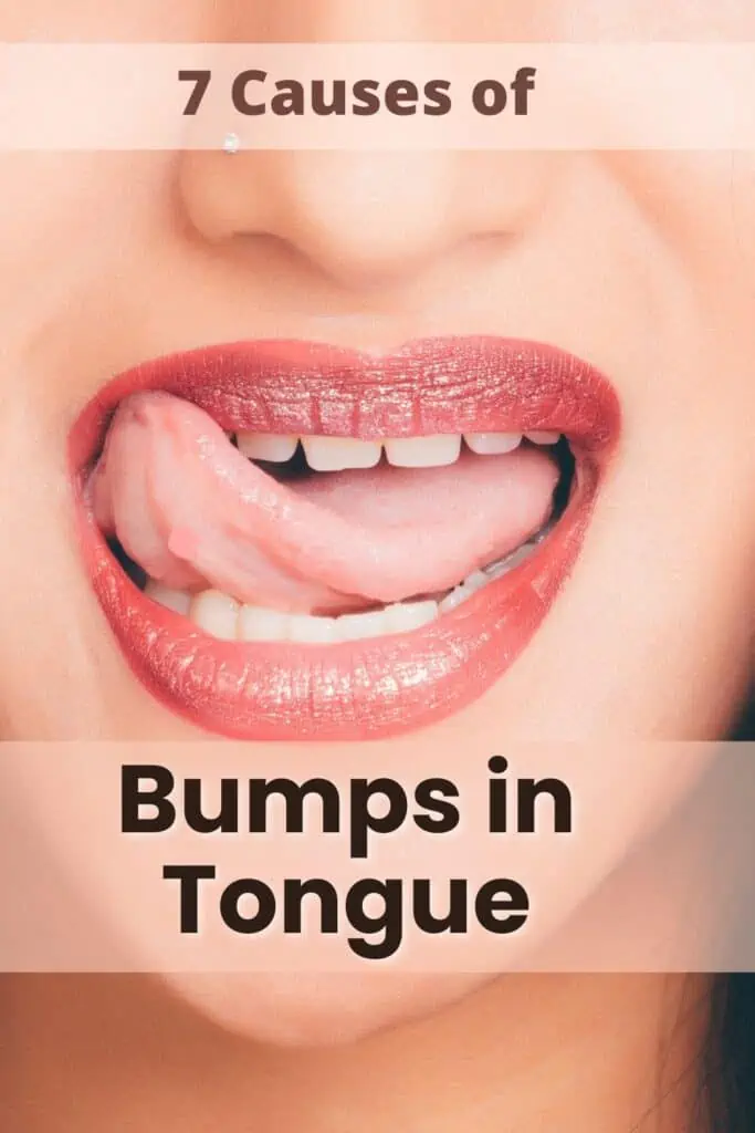 7 Causes of Bumps in The Back Of Your Tongue