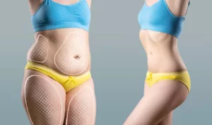 fat loss before and after